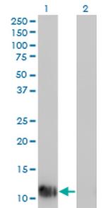 FABP1 Antibody in Western Blot (WB)