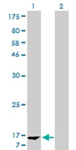 FABP1 Antibody in Western Blot (WB)