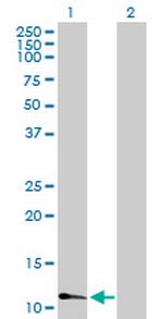 FABP3 Antibody in Western Blot (WB)