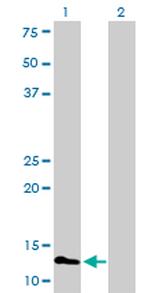 FABP3 Antibody in Western Blot (WB)