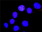 PTK2B Antibody in Proximity Ligation Assay (PLA) (PLA)