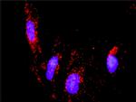 PTK2B Antibody in Proximity Ligation Assay (PLA) (PLA)