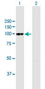 FAP Antibody in Western Blot (WB)