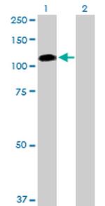 FAP Antibody in Western Blot (WB)