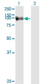 FAP Antibody in Western Blot (WB)