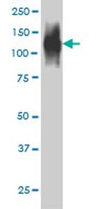 FAP Antibody in Western Blot (WB)