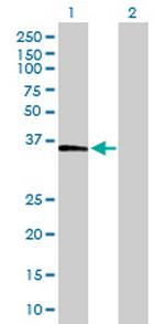 FBP1 Antibody in Western Blot (WB)