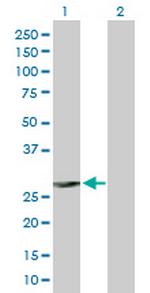 FCER1A Antibody in Western Blot (WB)