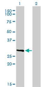 FCER1A Antibody in Western Blot (WB)