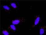 FGF1 Antibody in Proximity Ligation Assay (PLA) (PLA)