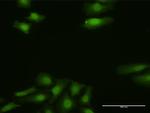 FGF13 Antibody in Immunocytochemistry (ICC/IF)