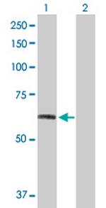 FGFR1 Antibody in Western Blot (WB)