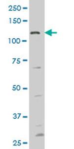 FGFR1 Antibody in Western Blot (WB)