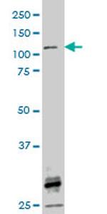 FGFR1 Antibody in Western Blot (WB)