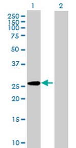 GPC5 Antibody in Western Blot (WB)