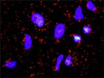 FGFR2 Antibody in Proximity Ligation Assay (PLA) (PLA)