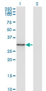 FGL1 Antibody in Western Blot (WB)