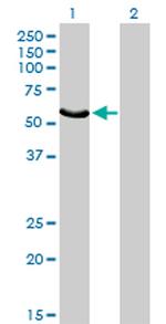 FGR Antibody in Western Blot (WB)