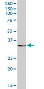 FHL1 Antibody in Western Blot (WB)