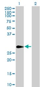 FHL1 Antibody in Western Blot (WB)