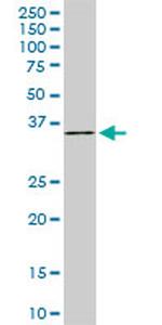 FHL1 Antibody in Western Blot (WB)