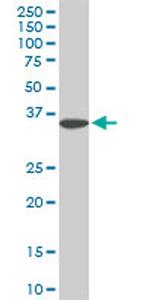 FHL1 Antibody in Western Blot (WB)