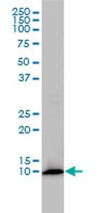 FKBP1A Antibody in Western Blot (WB)