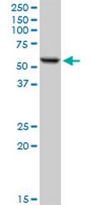 FKBP4 Antibody in Western Blot (WB)