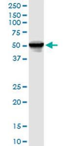 FKBP4 Antibody in Western Blot (WB)