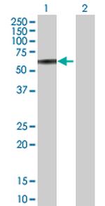 FKBP4 Antibody in Western Blot (WB)