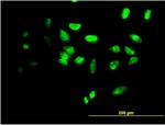 FOXF2 Antibody in Immunocytochemistry (ICC/IF)