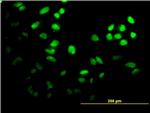 FOXF2 Antibody in Immunocytochemistry (ICC/IF)