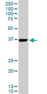 FOXF2 Antibody in Western Blot (WB)