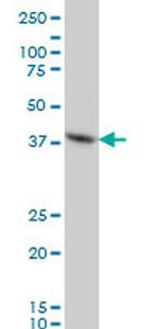 FOXF2 Antibody in Western Blot (WB)