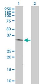 FOXL1 Antibody in Western Blot (WB)