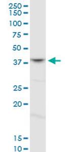 FOXL1 Antibody in Western Blot (WB)