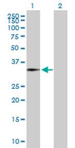 FOXJ1 Antibody in Western Blot (WB)