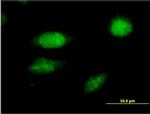 FOXC2 Antibody in Immunocytochemistry (ICC/IF)