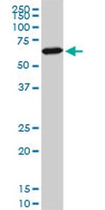 FOXC2 Antibody in Western Blot (WB)