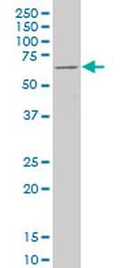 FOXC2 Antibody in Western Blot (WB)