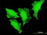 FOXO3A Antibody in Immunocytochemistry (ICC/IF)