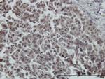 FOXO3A Antibody in Immunohistochemistry (Paraffin) (IHC (P))