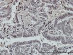 FOXO3A Antibody in Immunohistochemistry (Paraffin) (IHC (P))