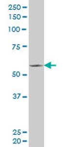 FLI1 Antibody in Western Blot (WB)