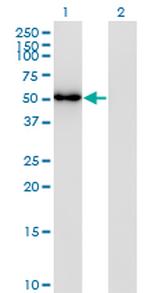 FLI1 Antibody in Western Blot (WB)