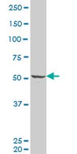 FLI1 Antibody in Western Blot (WB)