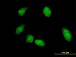 FLI1 Antibody in Immunocytochemistry (ICC/IF)