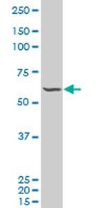 FLI1 Antibody in Western Blot (WB)