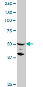 FLI1 Antibody in Western Blot (WB)