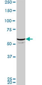 FLI1 Antibody in Western Blot (WB)